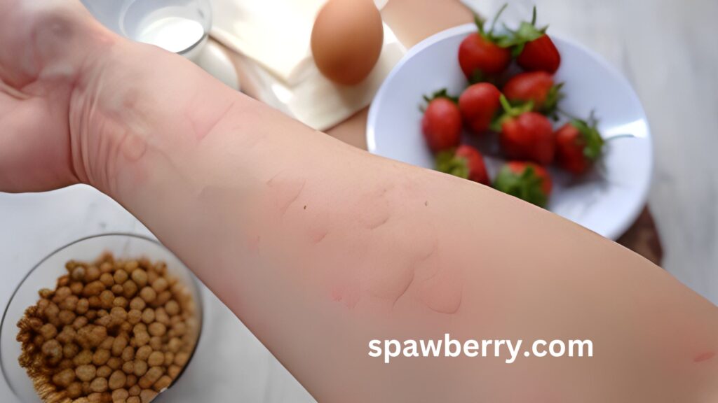 Can Strawberries Cause Allergies